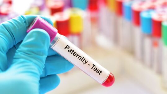 Come fare il test di paternità in gravidanza - esame