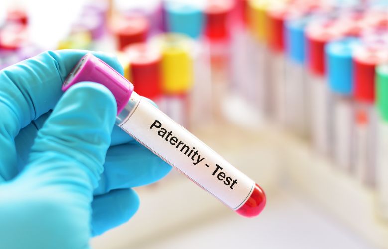 Come fare il test di paternità in gravidanza - esame